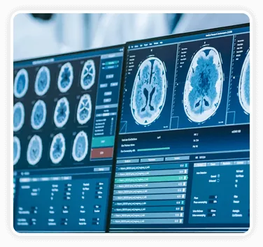 Brain scans displayed on laboratory monitors during neuroscience research